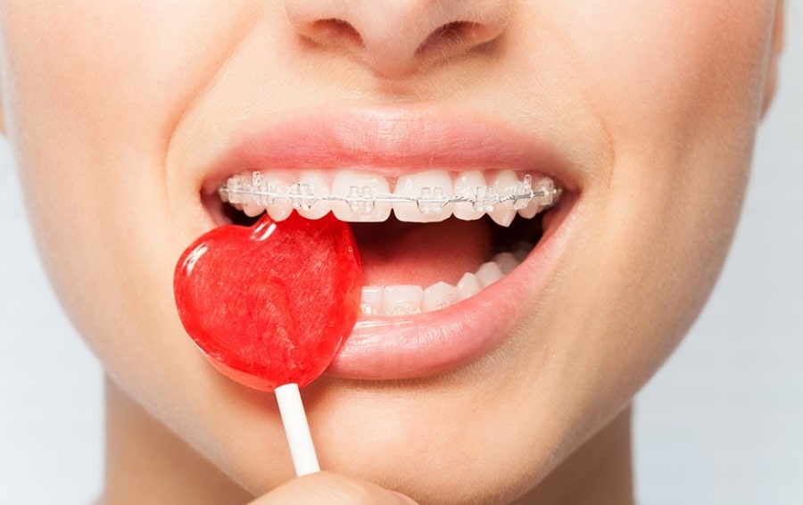 How Skittles Affect Your Teeth